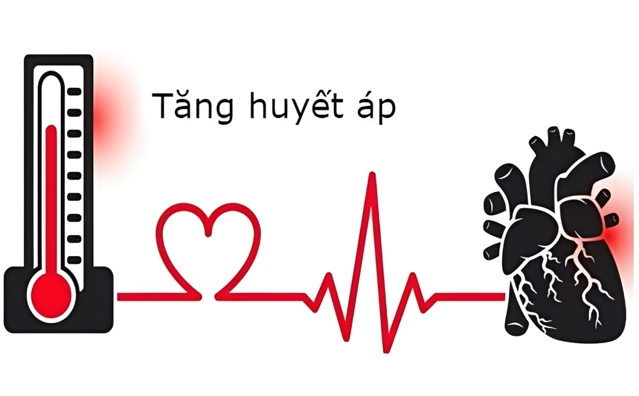 Tăng huyết áp