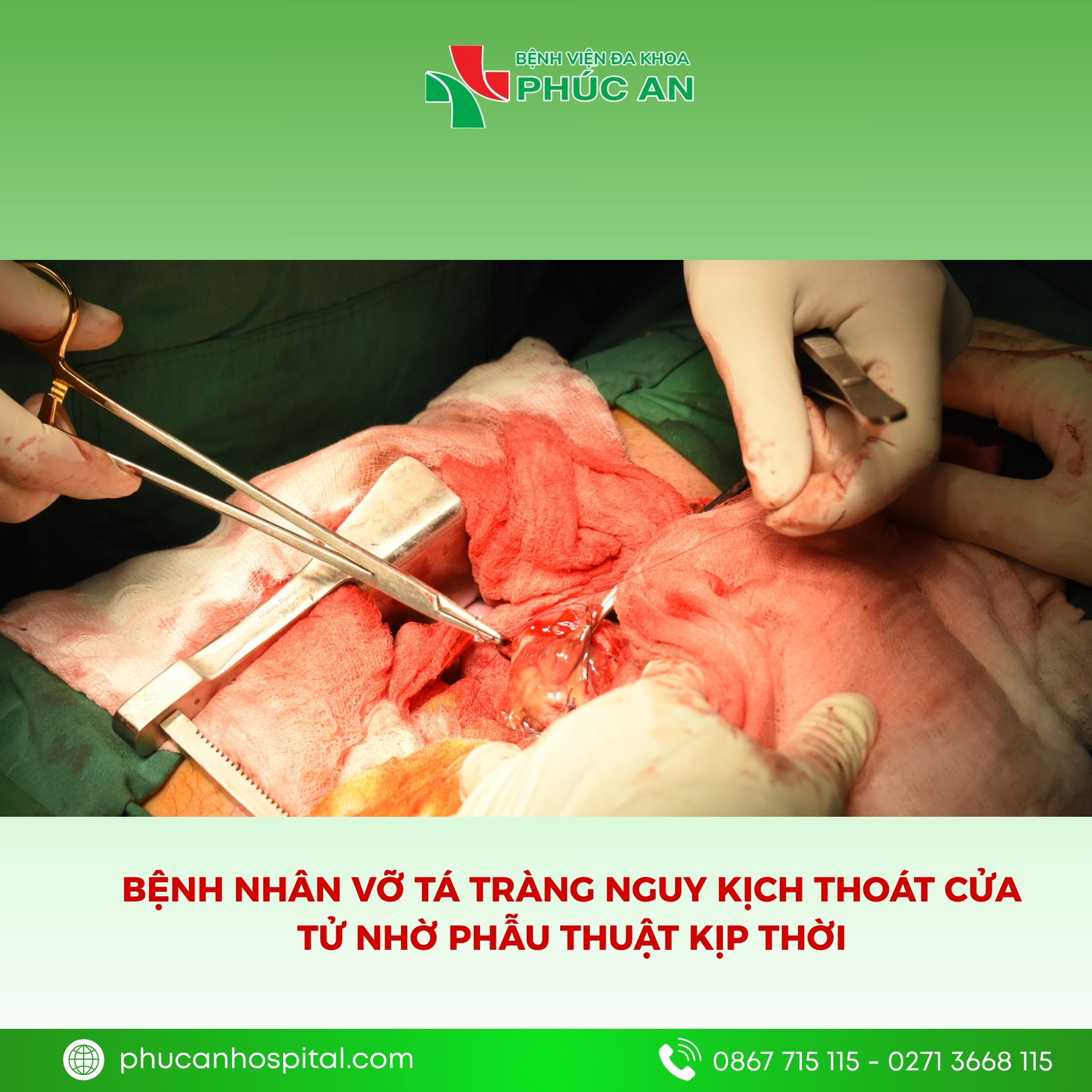 vỡ tá tràng