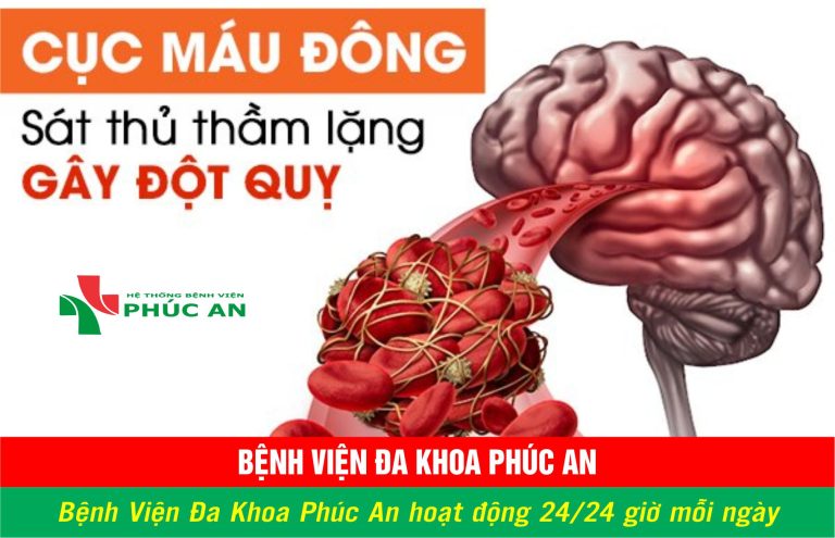 Nguyên nhân gây ra cục máu đông trong não