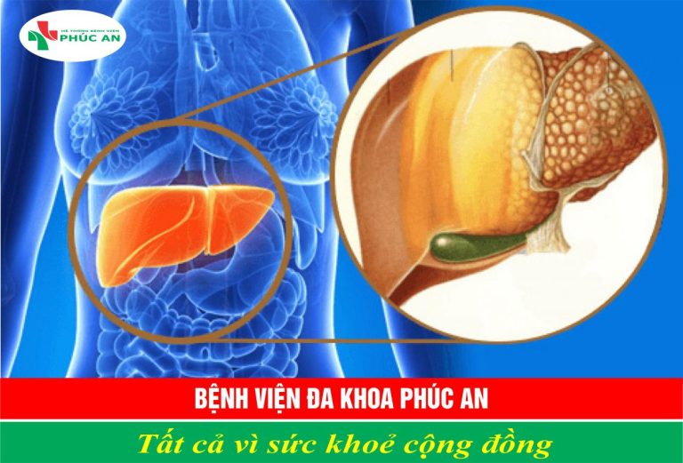 10 NGUY CƠ VÀ DẤU HIỆU CỦA BỆNH GAN