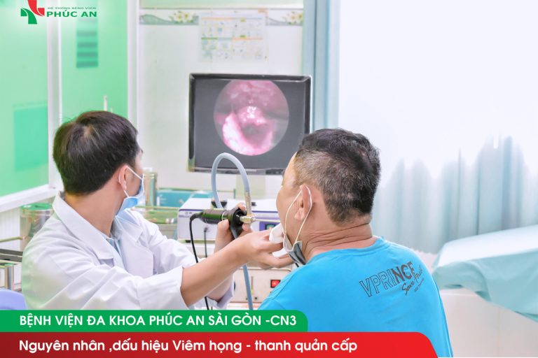 Nguyên nhân ,dấu hiệu viêm họng – Thanh quản cấp