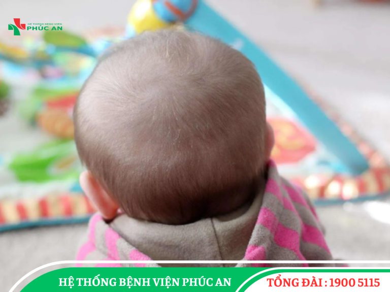 6 dấu hiệu tóc mọc bất thường chứng tỏ sức khỏe trẻ có vấn đề