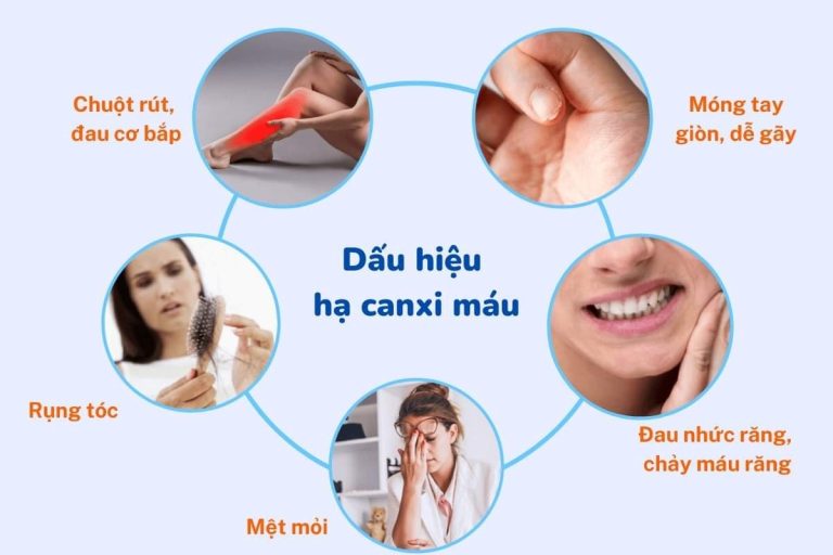CÁCH SƠ CỨU NGƯỜI BỊ HẠ CANXI MÁU