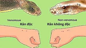 CÁCH SƠ CẤP CỨU ĐÚNG KHI BỊ RẮN ĐỘC CẮN