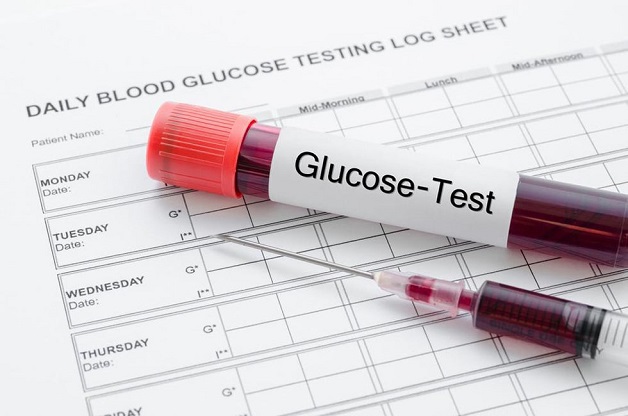 Khi nào cần xét nghiệm định lượng Glucose máu?