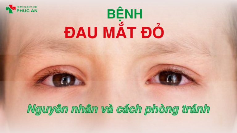 ĐAU MẮT ĐỎ LÂY QUA ĐƯỜNG NÀO VÀ CÁCH PHÒNG TRÁNH