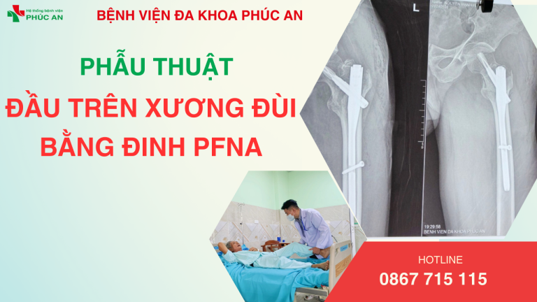 BVĐK PHÚC AN THỰC HIỆN PHẪU THUẬT XƯƠNG ĐÙI BẰNG ĐINH PFNA CHO CỤ ÔNG 65 TUỔI