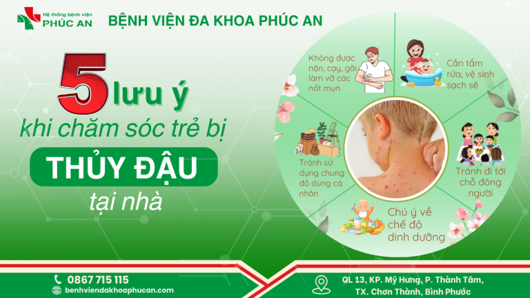 5 Lưu Ý Khi Chăm Sóc Trẻ Bị Thủy Đậu Tại Nhà