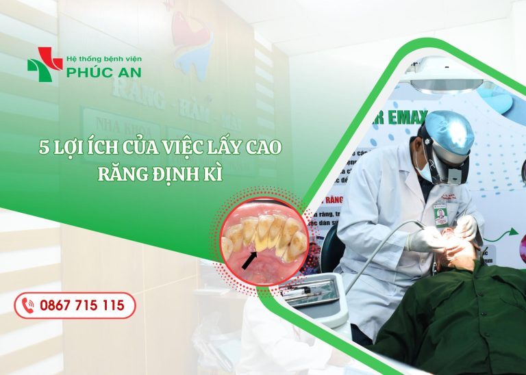 5 LỢI ÍCH CỦA VIỆC LẤY CAO RĂNG ĐỊNH KÌ