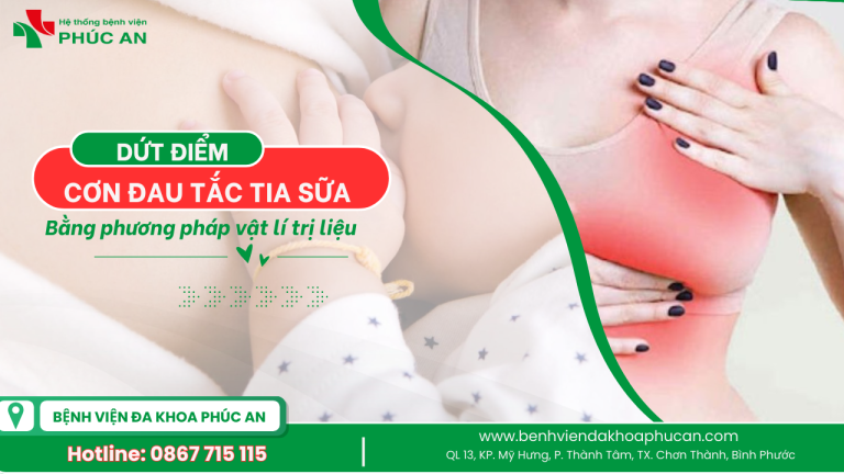 Điều Trị Tắc Tia Sữa Bằng Vật Lí Trị Liệu