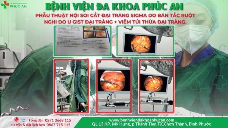 PHẪU THUẬT NỘI SOI CẮT ĐẠI TRÀNG SIGMA DO BÁN TẮC RUỘT, VIÊM TÚI THỪA ĐẠI TRÀNG