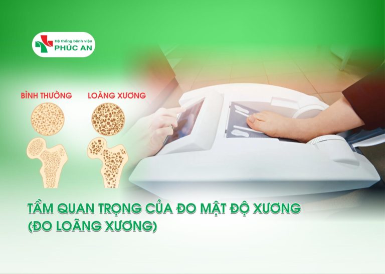 TẦM QUAN TRỌNG CỦA ĐO MẬT ĐỘ XƯƠNG (ĐO LOÃNG XƯƠNG)