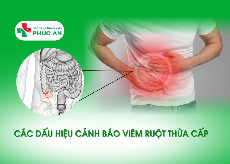 CÁC DẤU HIỆU CẢNH BÁO VIÊM RUỘT THỪA CẤP