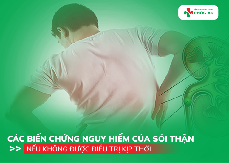 CÁC BIẾN CHỨNG NGUY HIỂM CỦA SỎI THẬN NẾU KHÔNG ĐƯỢC ĐIỀU TRỊ KỊP THỜI