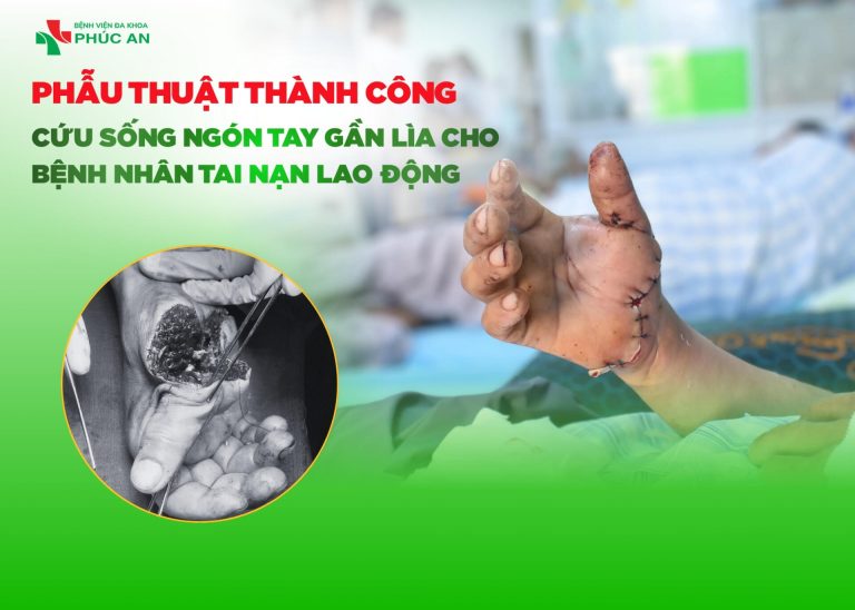 PHẪU THUẬT THÀNH CÔNG CỨU SỐNG NGÓN TAY GẦN LÌA CHO BỆNH NHÂN TAI NẠN LAO ĐỘNG