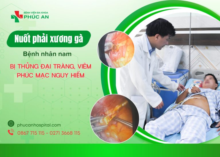 NUỐT XƯƠNG GÀ TƯỞNG VÔ HẠI, BỆNH NHÂN NAM BỊ THỦNG ĐẠI TRÀNG, VIÊM PHÚC MẠC NGUY HIỂM