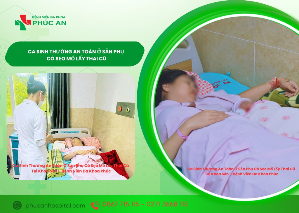 CA SINH THƯỜNG AN TOÀN Ở SẢN PHỤ CÓ SẸO MỔ LẤY THAI CŨ