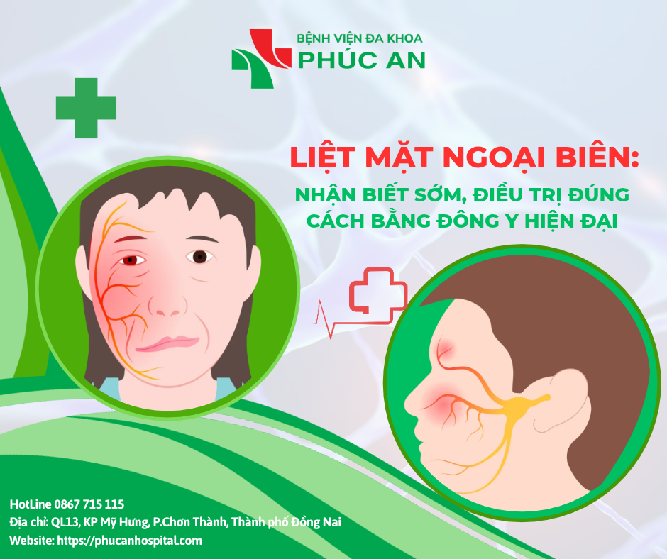 LIỆT MẶT NGOẠI BIÊN: NHẬN BIẾT SỚM, ĐIỀU TRỊ ĐÚNG CÁCH BẰNG ĐÔNG Y HIỆN ĐẠI